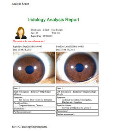 Green Iris Recognition Camera Iridology Device อังกฤษสเปนจีน