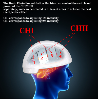 Rtms Therapy Brain Helmet เครื่องกระตุ้นแม่เหล็ก Transcranial Photobiomodulation