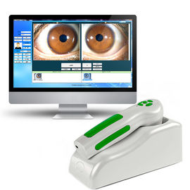 ความละเอียดสูง USB Digital Iridology Eye Iriscope ความละเอียดสูง 12 MP