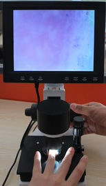 กล้องจุลทรรศน์แบบเส้นเลือดฝอย 380000 พิกเซลพร้อม CE
