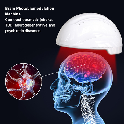 หมวกนิรภัย Photobiomodulation การบำบัดด้วยแสงสำหรับเหตุการณ์ที่กระทบกระเทือนจิตใจ (โรคหลอดเลือดสมอง การบาดเจ็บของสมองที่กระทบกระเทือนจิตใจ และภาวะขาดเลือดทั่วโลก)