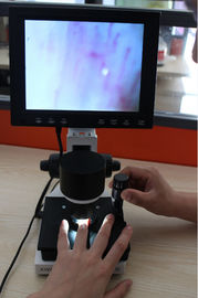 มัลติฟังก์ชั่น Multi Site Microcirculation Microscope / กล้องจุลทรรศน์แบบพับเส้นเลือดฝอยสำหรับโรงพยาบาล
